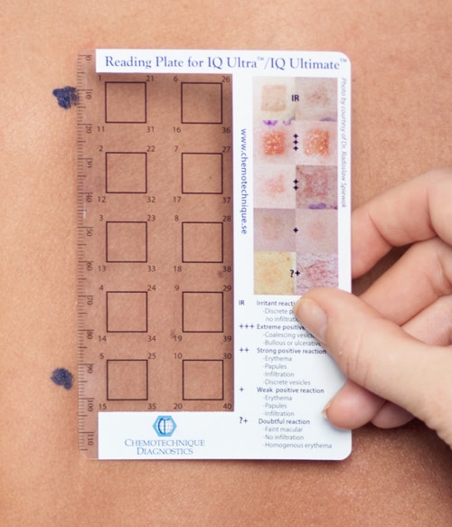 skin patch test